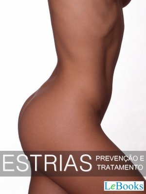 cover image of Estrias